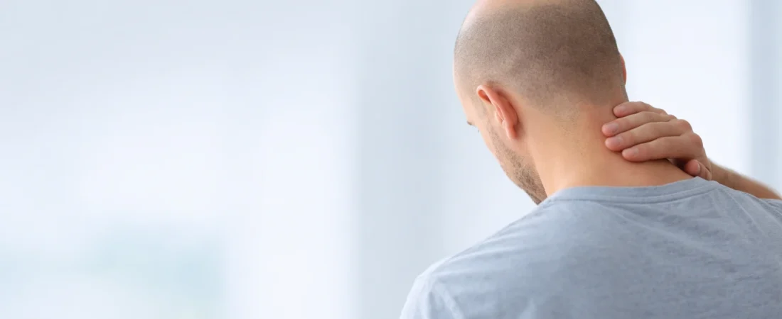 Qué es la micropigmentación capilar y para quién puede ser una buena opción