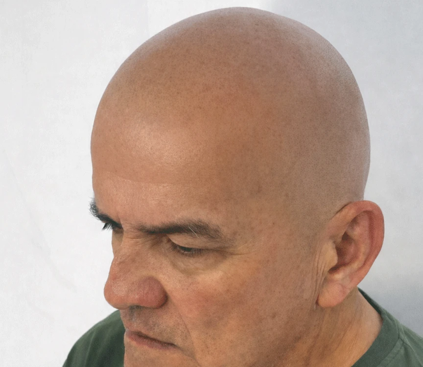 Tatuaje capilar efecto rapado, antes