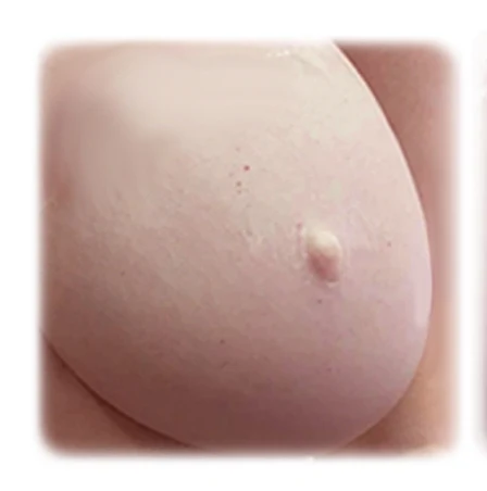 Tatuaje de areola post-mastectomía, antes