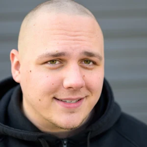 Efecto Rapdado micorpigmetnación capilar