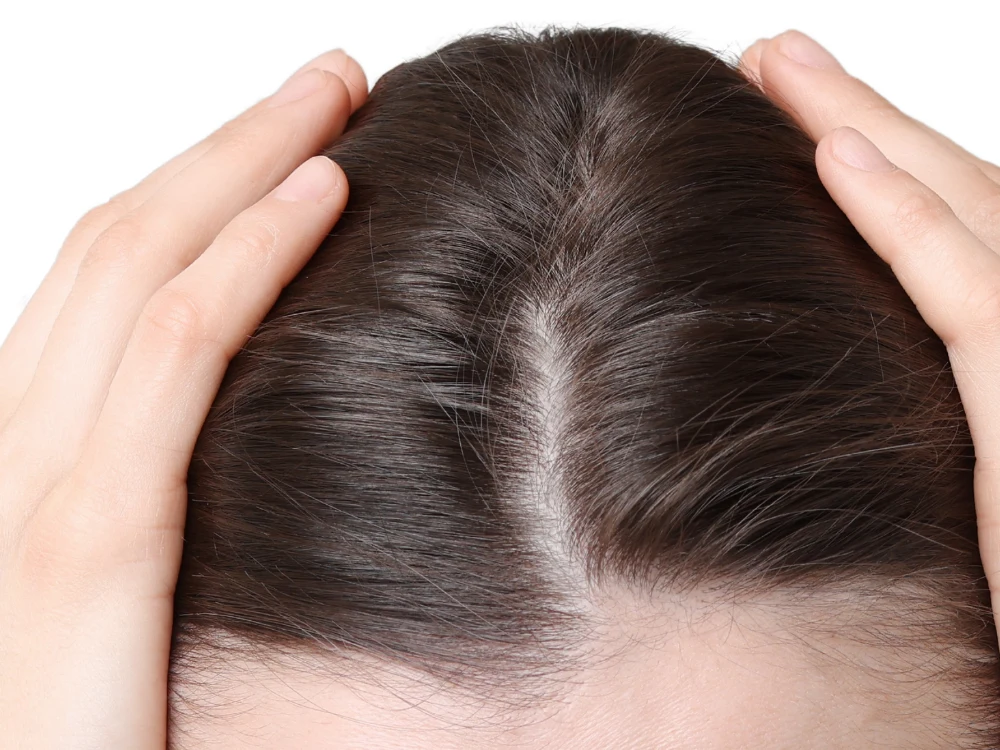 Densidad pelo mujer, antes