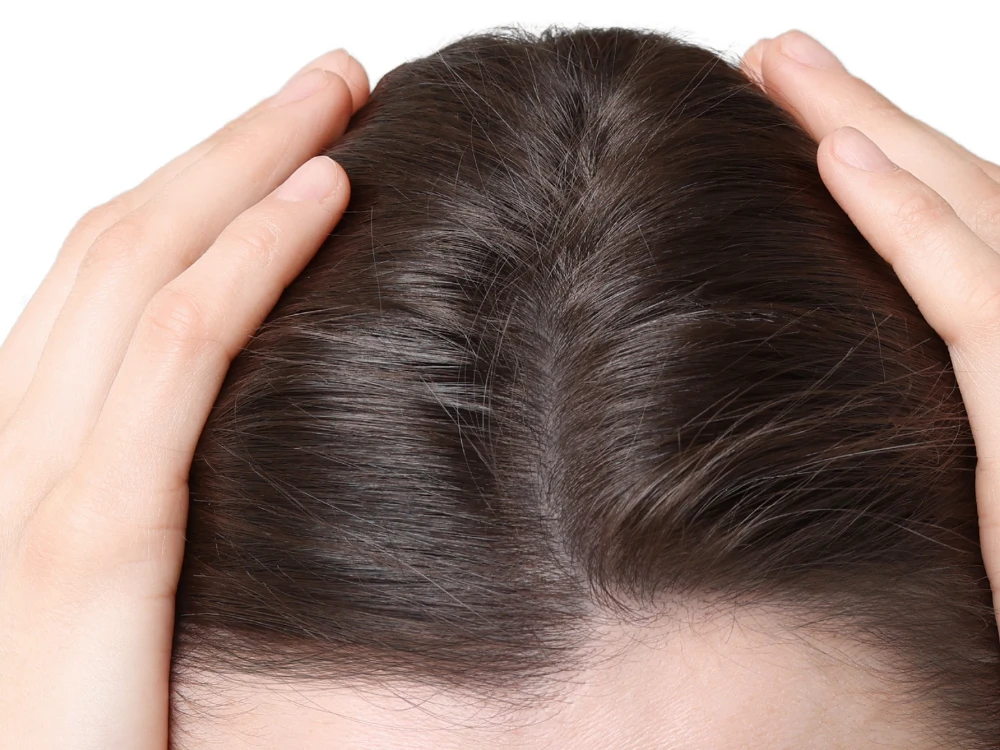 Densidad pelo mujer, después